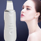 ANLAN Ultrasonic Blackhead Remover and Exfoliator