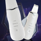 ANLAN Ultrasonic Blackhead Remover and Exfoliator